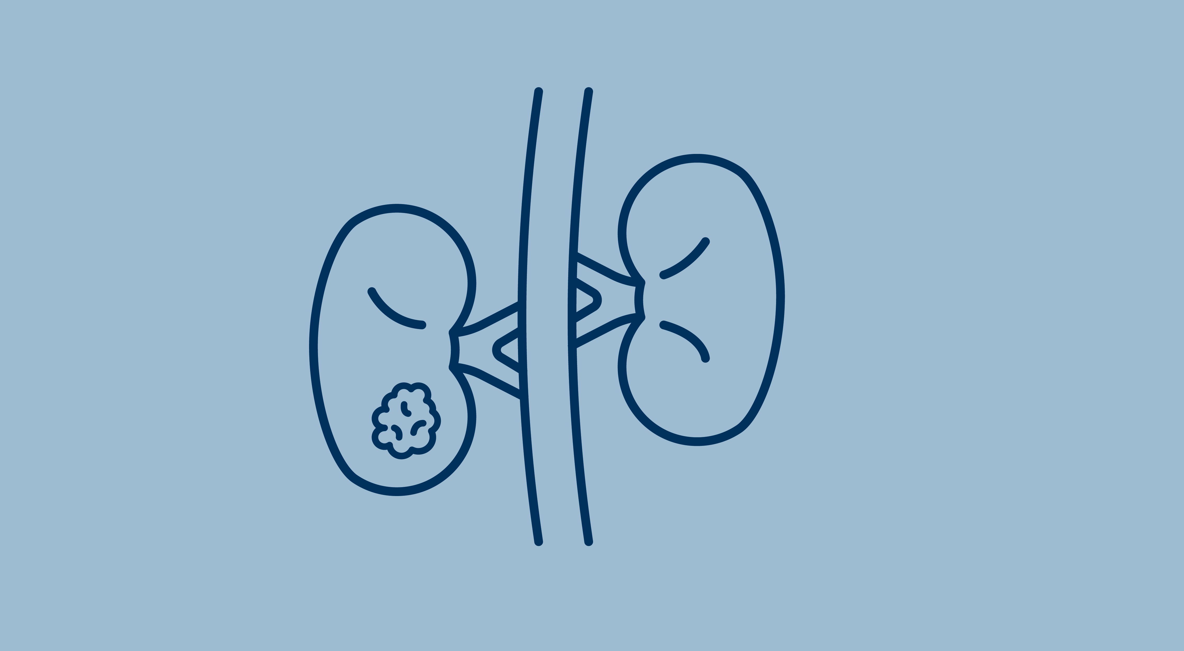 kidneys