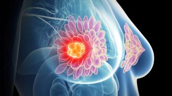 Graphic of a breast with a tumor