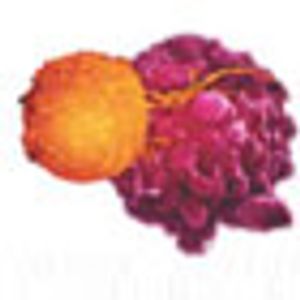 Immunotherapy: Personalized Treatment for Advanced Prostate Cancer