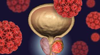 Rendering of a bladder and prostate, surrounded by images of cancerous cells