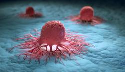 Olaparib Dosage Can Be Reduced Without Affecting Survival in Ovarian Cancer 