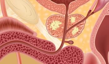 Patients With Advanced Prostate Cancer Report Positive Wellbeing Scores While Receiving Apalutamide 