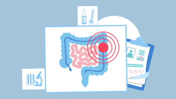 Illustration of a GI tract with a tumor