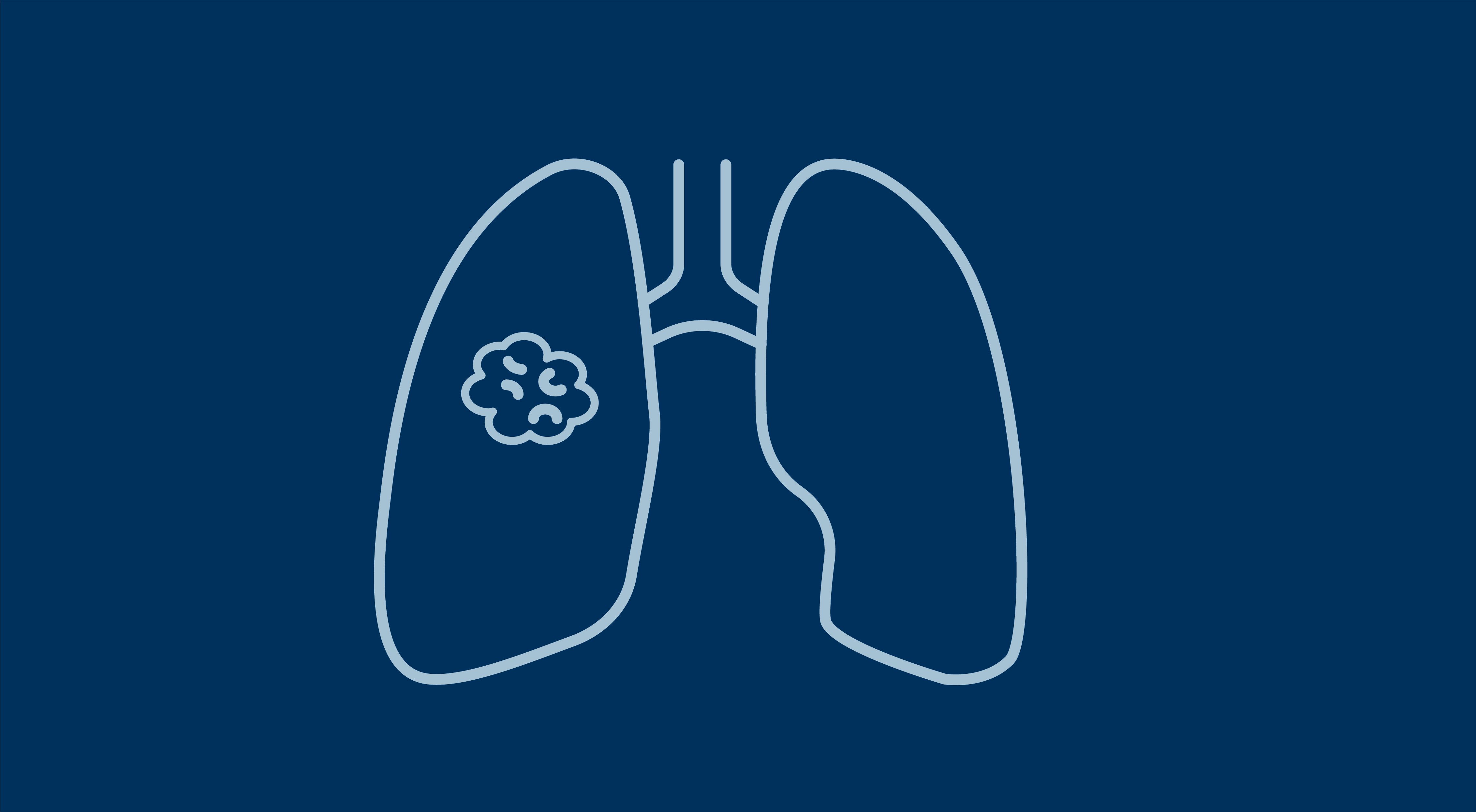 lung cancer