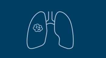 Simple light blue line illustration of a lung with a tumor on a dark blue background