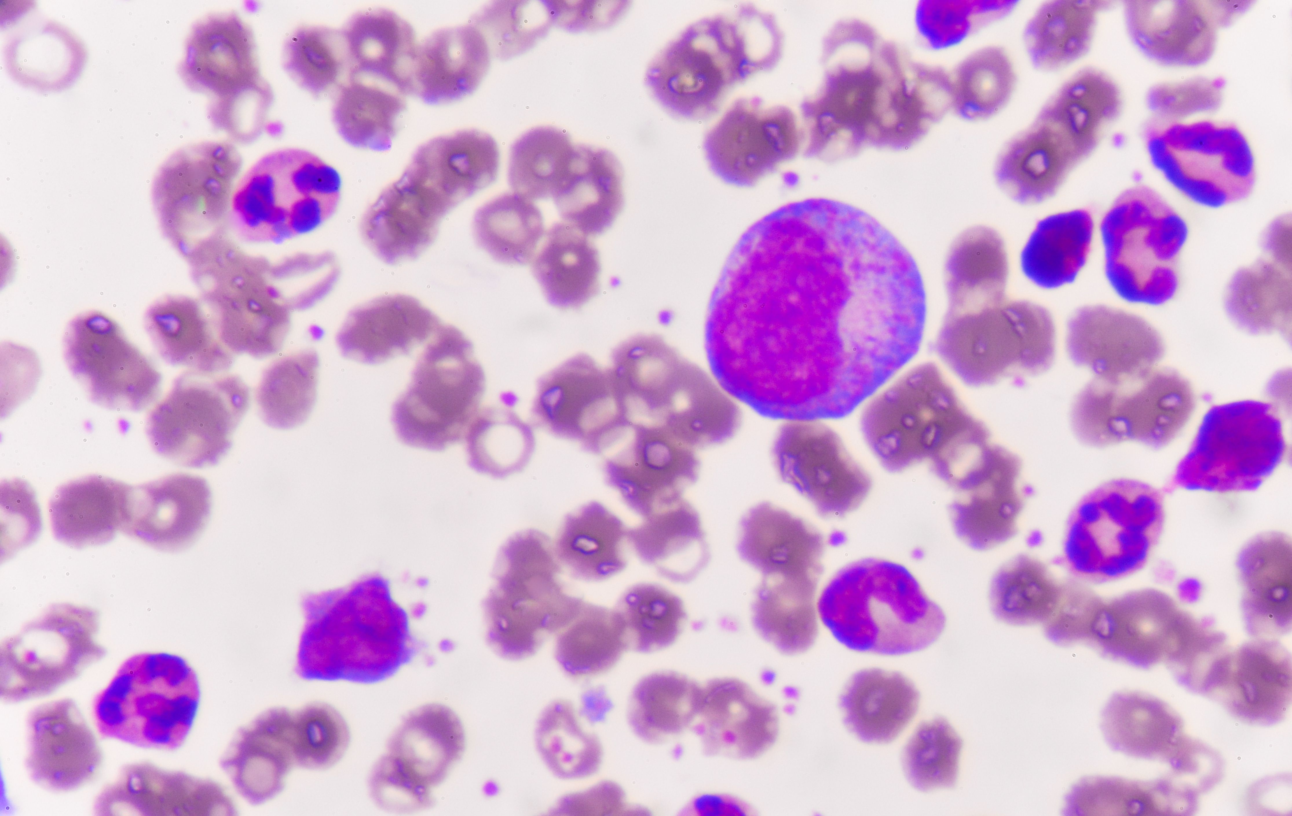 Graphic of myeloma cells