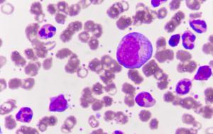 Visual of bone marrow cells