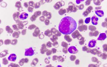 Graphic of myeloma cells