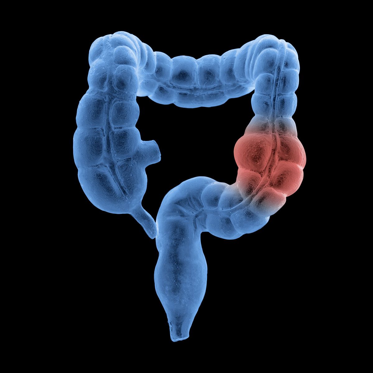 Anatomical graphic of a colon
