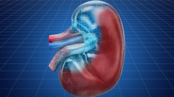 kidney cancer