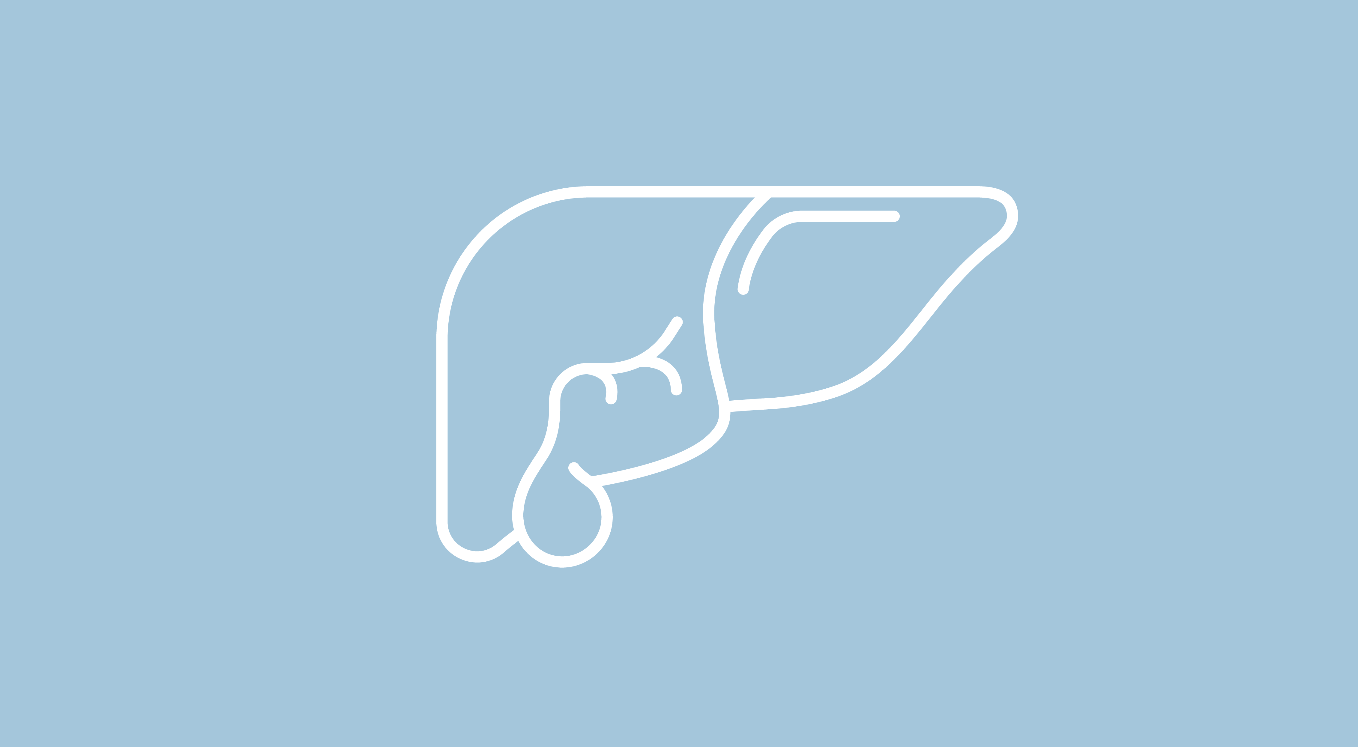 Lenvatinib Dose Escalation Is Associated With Favorable Outcomes in Patients with HCC