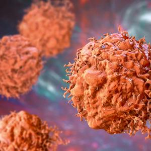 Graphic of endometrial cancer cells