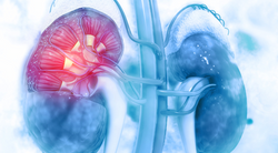 Evolution of Frontline VEGF TKI/Immunotherapy Treatments Propels Field of Renal Cell Carcinoma