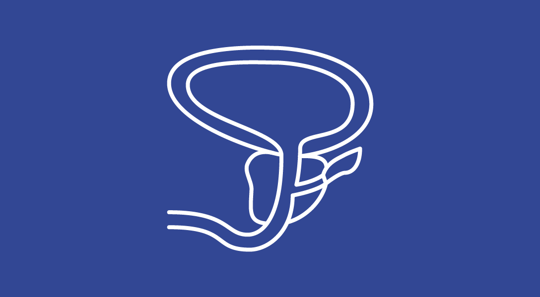 Illustration of prostate.