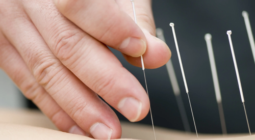 Auricular Acupuncture Offers Complimentary Approach to Manage Cancer Pain