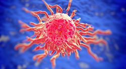 Promising Pathologic Complete Response Rate Observed With Neoadjuvant Cemiplimab in Cutaneous Squamous Cell Carcinoma