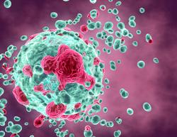 Patients with Recurrent or Metastatic Nasopharyngeal Carcinoma Report Improved PFS with Frontline Toripalimab Plus Gemcitabine/Cisplatin