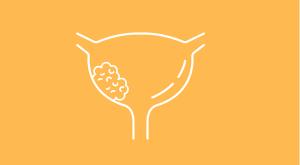 Rx Road Map: Enfortumab Vedotin (Padcev)