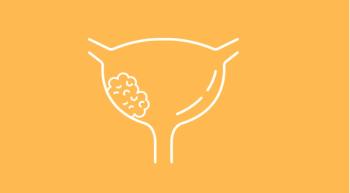 Bladder Cancer