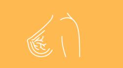 Sacituzumab Govitecan Continues to Prolong Survival in Patients With HR+/HER2– Breast Cancer