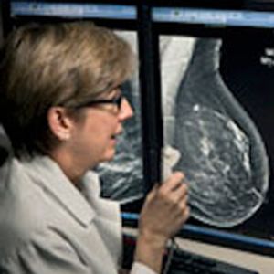 3D Mammograms Improve Breast Cancer Detection, Reduce Callbacks