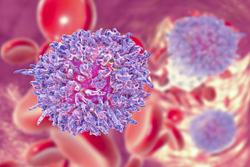 Monitoring Amphiregulin May Be Warranted in Caring for Patients with Acute GVHD