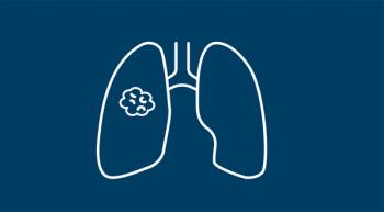 lung cancer