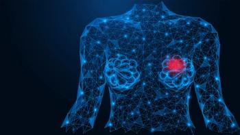 Graphic of a breast with a tumor