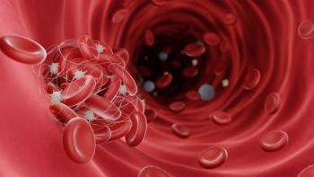 Graphic of venous thromboembolism