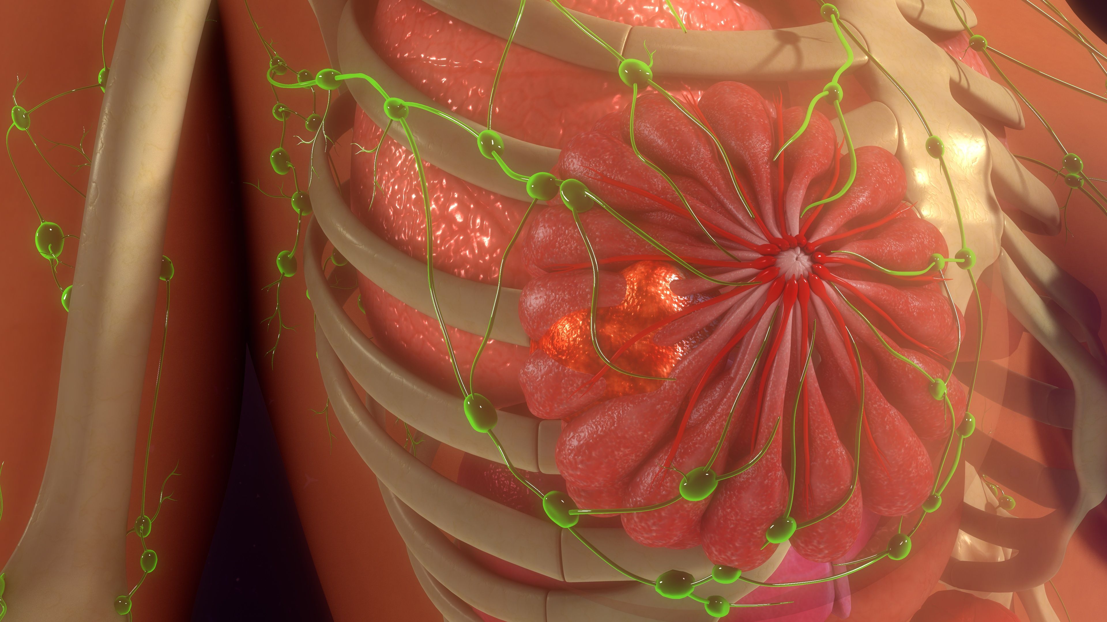 metastatic breast cancer