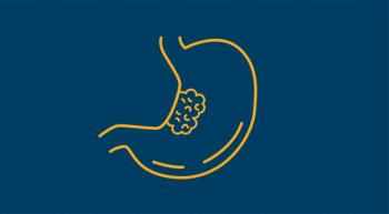 Gastric Cancer