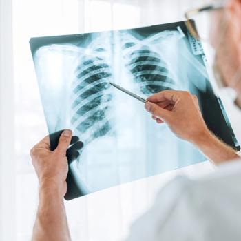 Image of an X-ray of lungs being reviewed by a clinician.