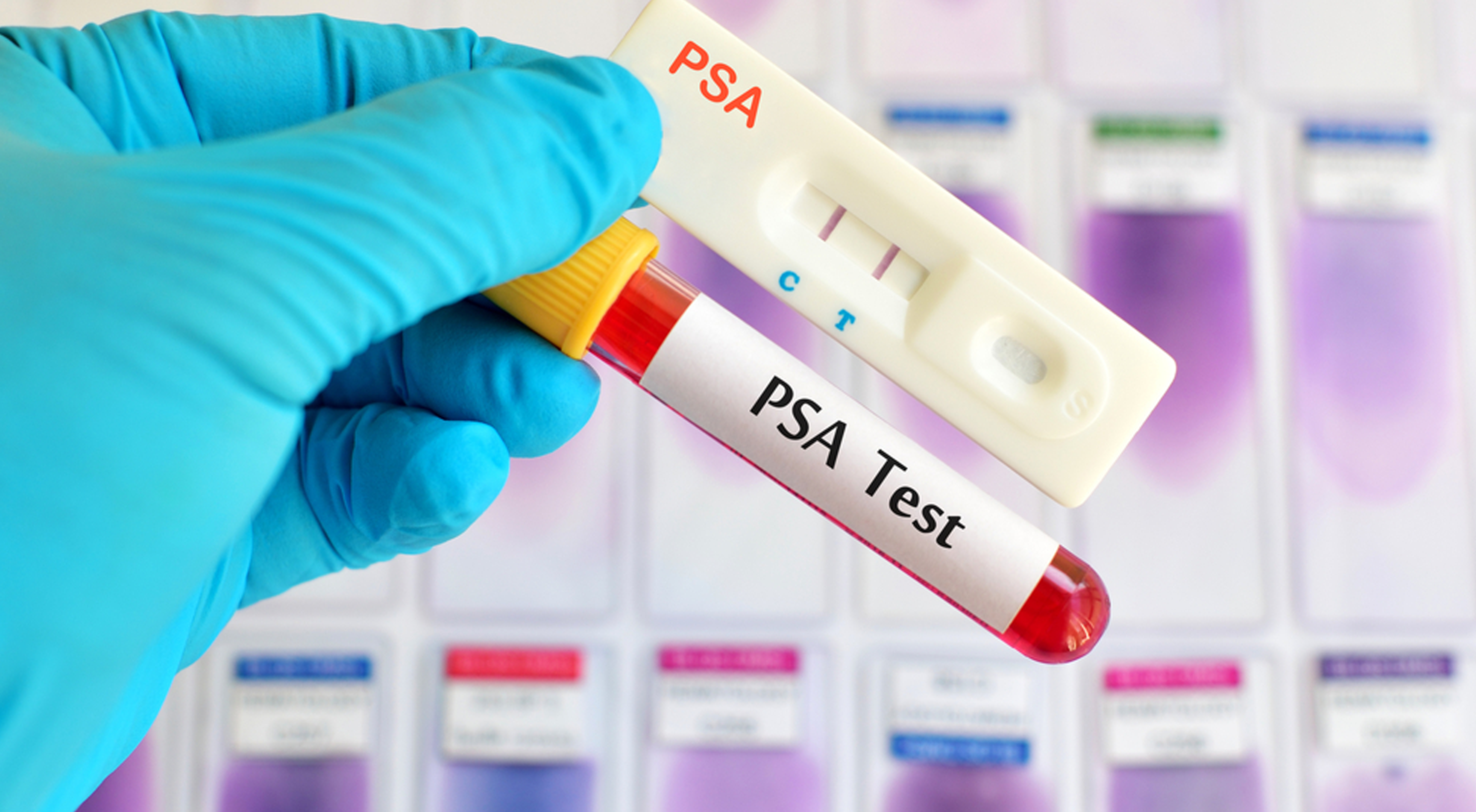 a gloved hand holding a test tube and another test for PSA levels