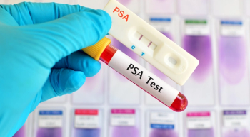 a gloved hand holding a test tube and another test for PSA levels