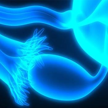 Graphic of an ovary