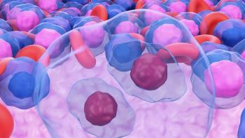 image of lymphoma cells