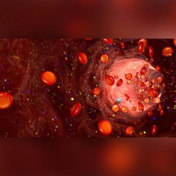Rendering of red blood cells with multiple myeloma