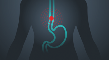 dark outline of a body with an esophagus featuring a red dot