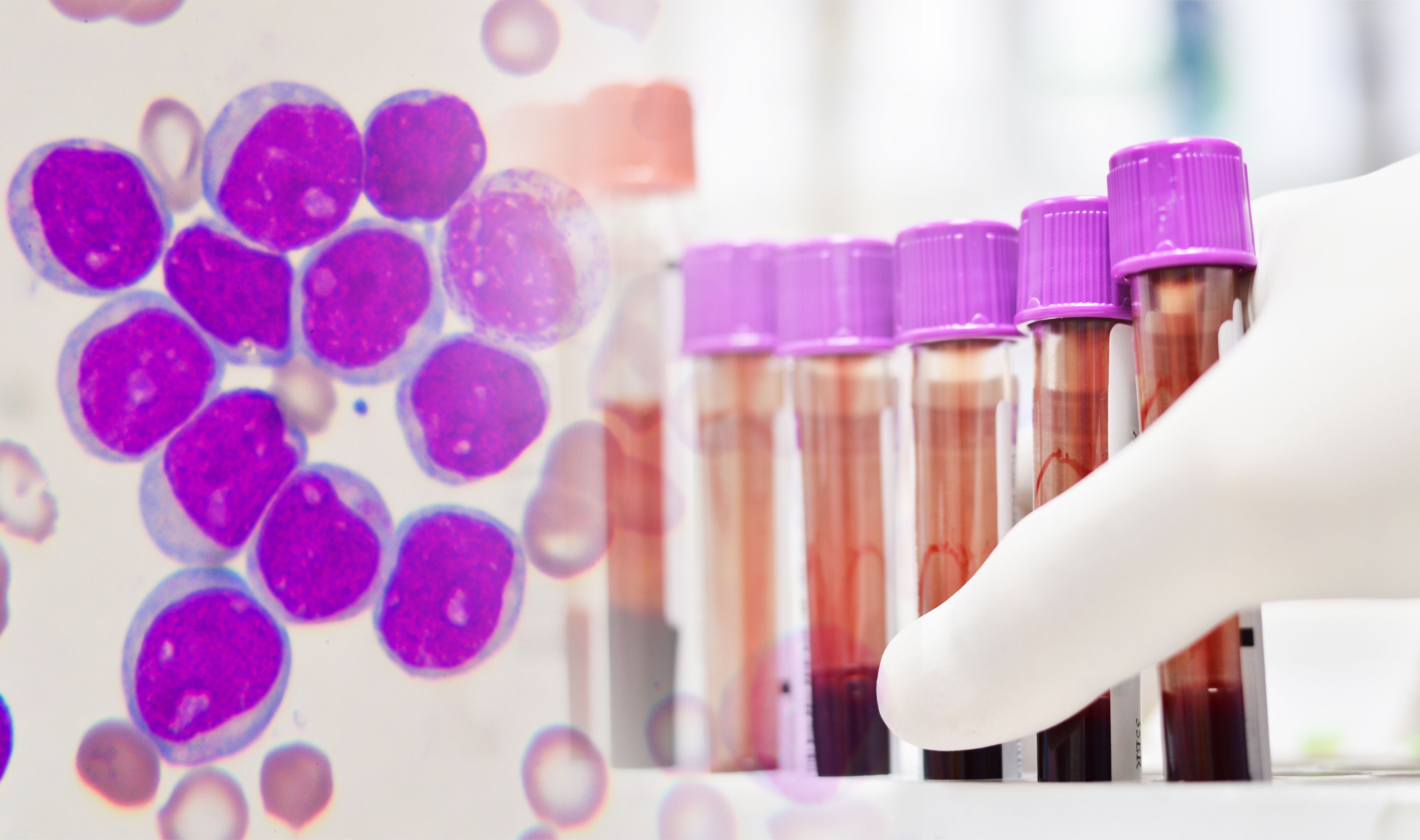 blood vials with cells