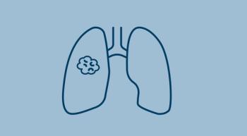 lung with cancerous tumor in it