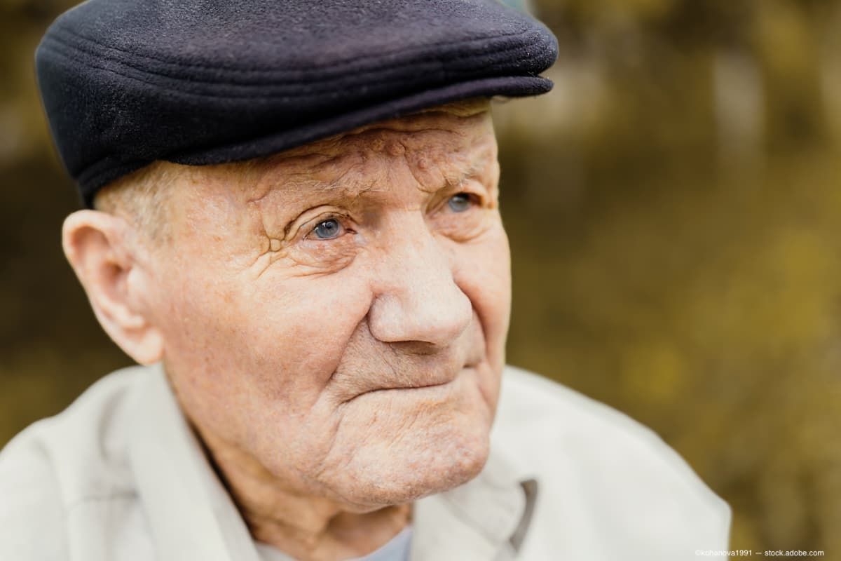 Prevalencia de degeneración macular miópica en personas de 85 años y más