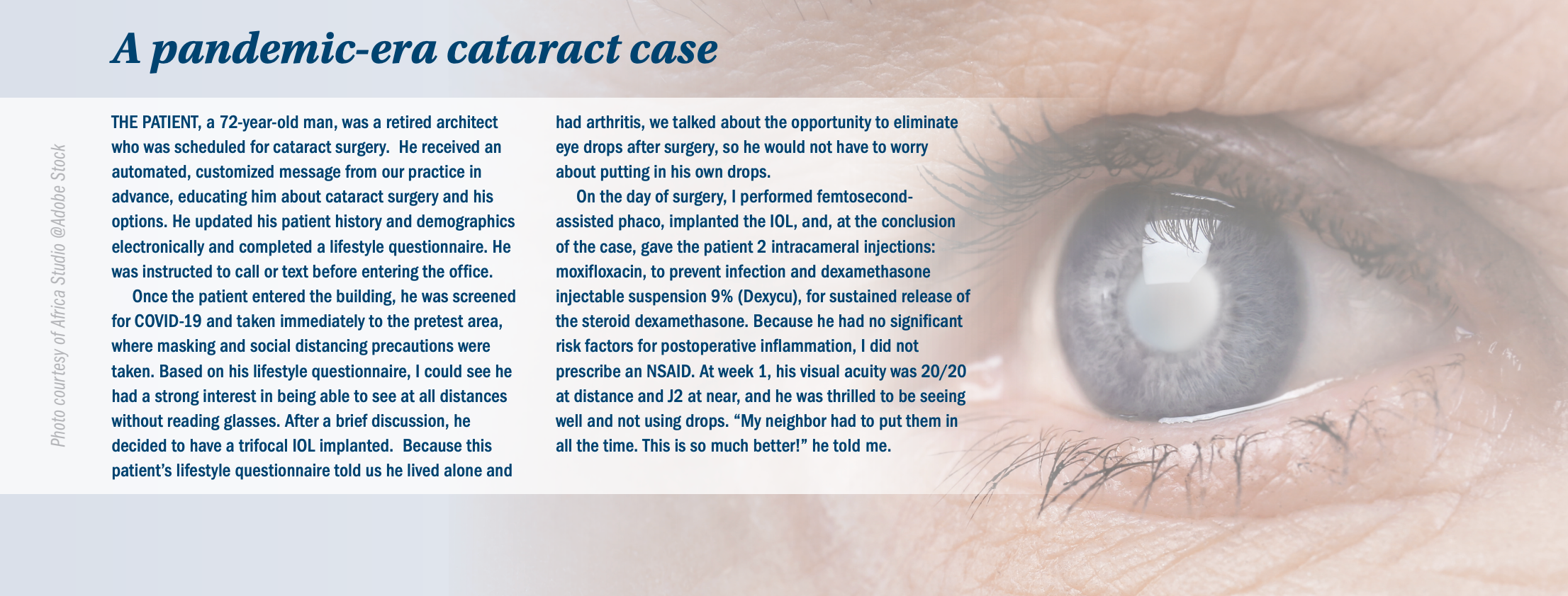 A pandemic-era cataract case
