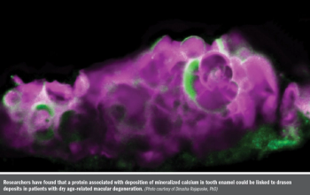 Protein associated with deposition of mineralized calcium in tooth enamel