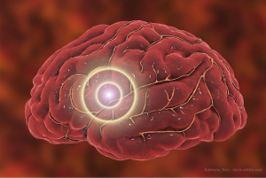 Therapies, trends make waves in neuro-ophthalmology 