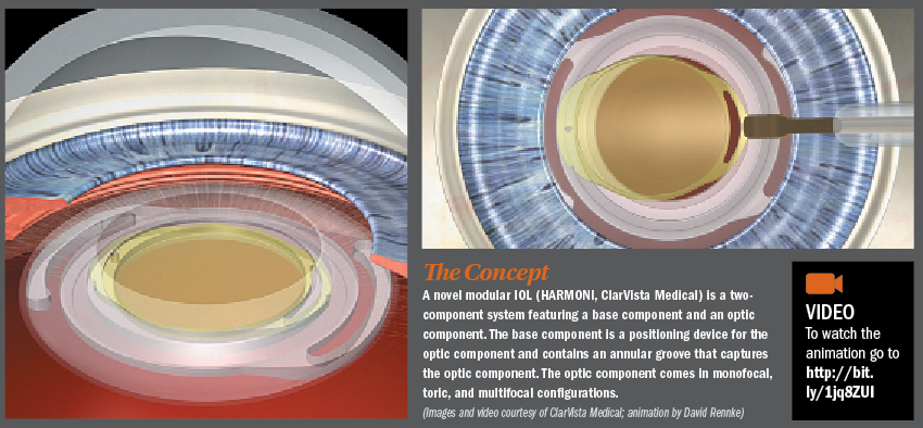 Modular IOL system begins clinical evaluation