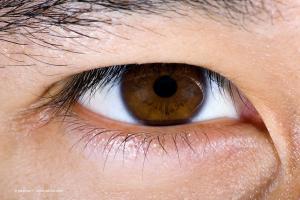 Blog: A new era for refractive surgery in the United States: STAAR EVO ICL wins FDA approval
