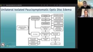 NeuroOp Guru: Unilateral isolated paucisymptomatic optic disc edema - what is that?