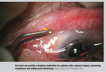 A hands-free treatment regimen is found to be safe and effective compared with a conventional eyedrop regimen.