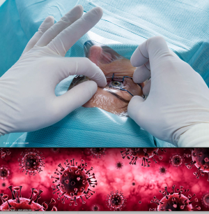 Changing patient conversations around cataract surgery