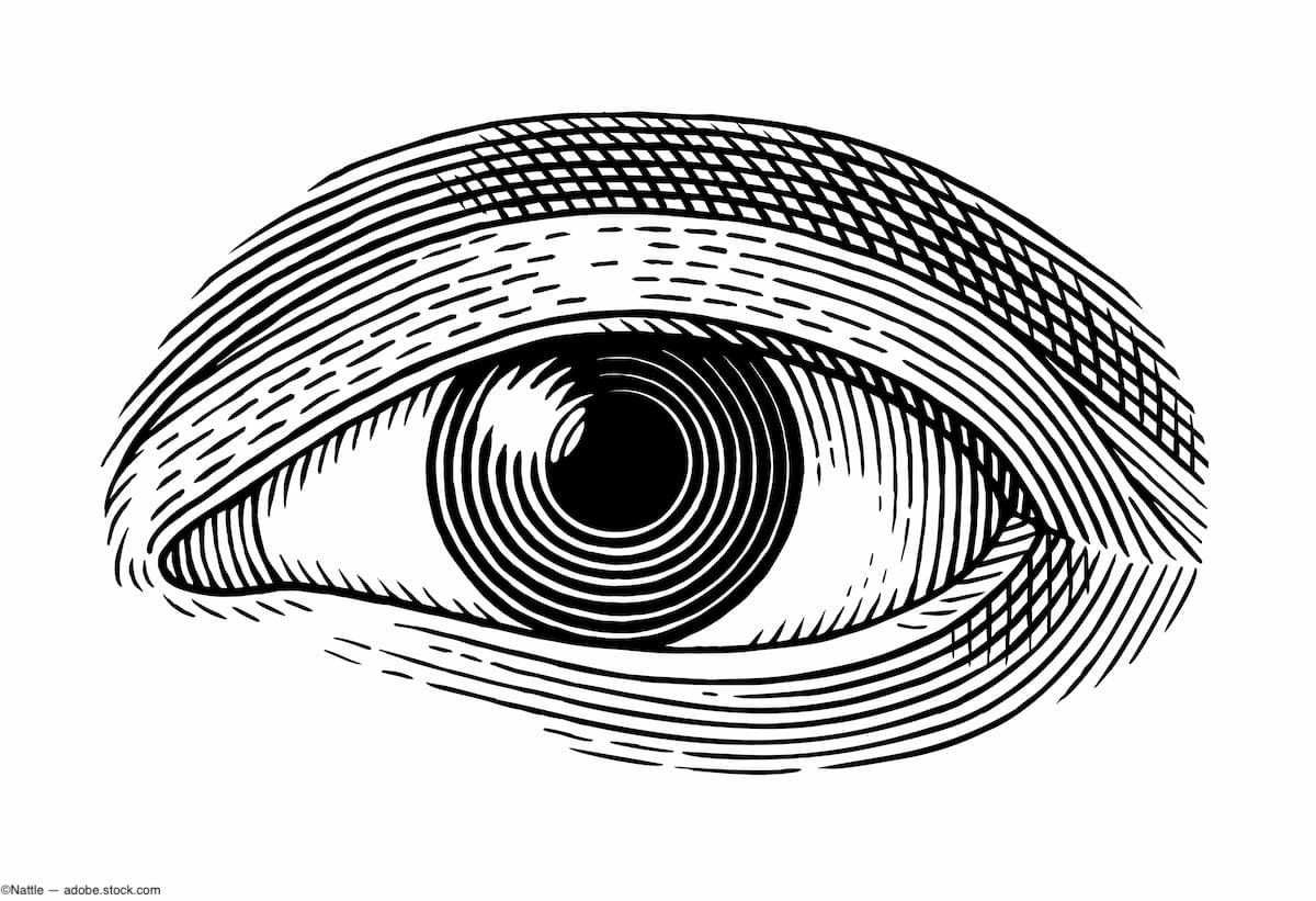 Gaining control of persistent corneal epithelial defects using AMT and a pressure patch